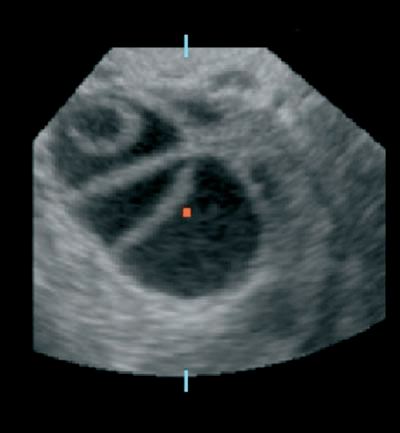 INFORMATIONAL TOOLS FOR ASSISTANCE OF SONOGRAPHIC EXAMINATIONS